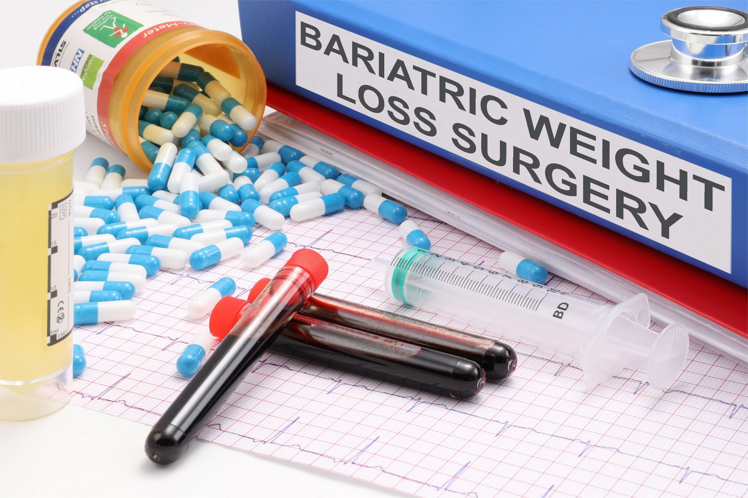 Bariatric Weight Loss Surgery - Free of Charge Creative Commons Medical  image