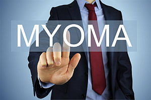 myoma