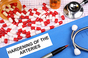hardening of the arteries