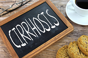 cirrhosis
