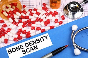 bone density scan
